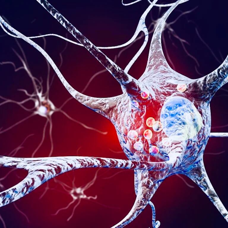 La relación entre el Parkinson y la pérdida de memoria: Cómo afecta esta enfermedad neurodegenerativa a nuestras capacidades cognitivas
